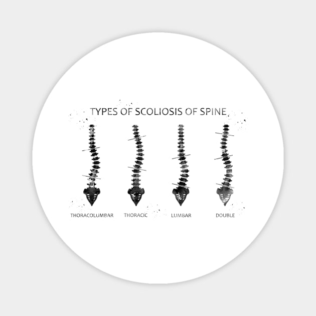 Type of scoliosis of spine Magnet by erzebeth